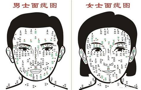 左腳側邊有痣|脚痣的位置与命运图解大全 脚下有痣哪个位置最好